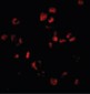 SUMO1 / SMT3 Antibody (N-Terminus)